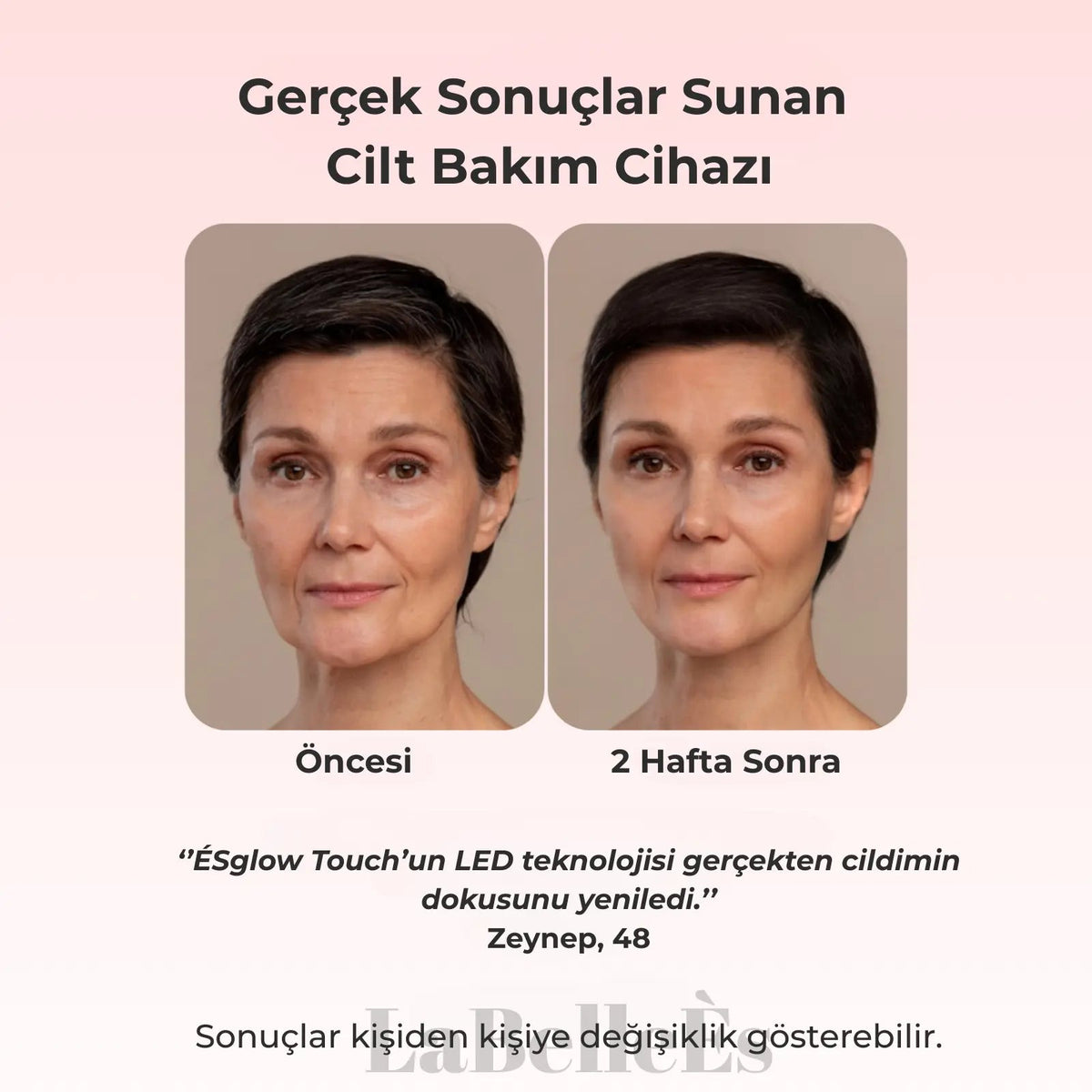 ÉSGLOW LED TERAPİSİ 7 IN 1
