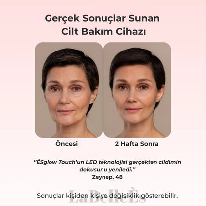 ÉSGLOW LED TERAPİSİ 7 IN 1